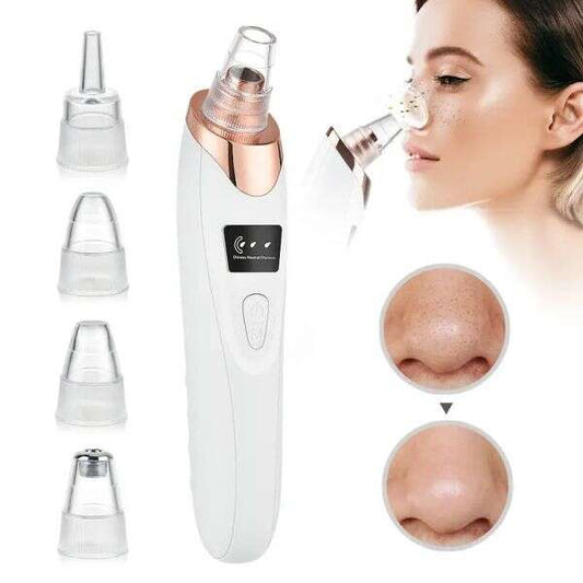 Electric blackhead remover and pore cleaner
